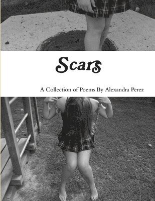 Scars 1