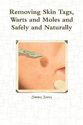 Removing Skin Tags, Warts and Moles and Safely and Naturally 1