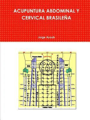 Acupuntura Abdominal Y Cervical Brasilea 1
