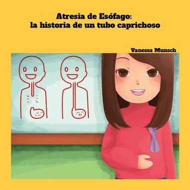 bokomslag Atresia de Esófago: la historia de un tubo caprichoso