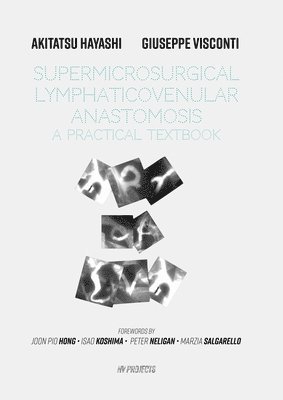Supermicrosurgical LymphaticoVenular Anastomosis 1