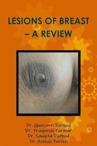 bokomslag Lesions of Breast - A Review