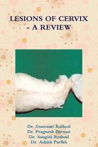 bokomslag Lesions of Cervix - A Review