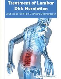 bokomslag Treatment of Lumbar Disk Herniation: Back Pain Relief and Herniated Discs Solutions