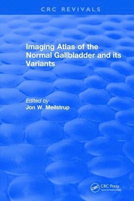 bokomslag Imaging Atlas of the Normal Gallbladder and Its Variants