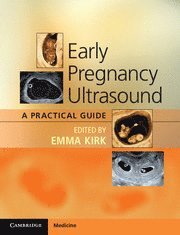 Emma Kirk - Early Pregnancy Ultrasound, Häftad