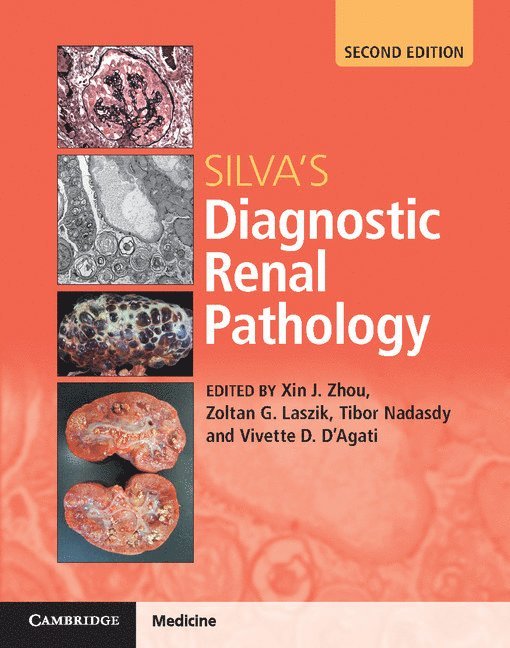 Silva's Diagnostic Renal Pathology 1