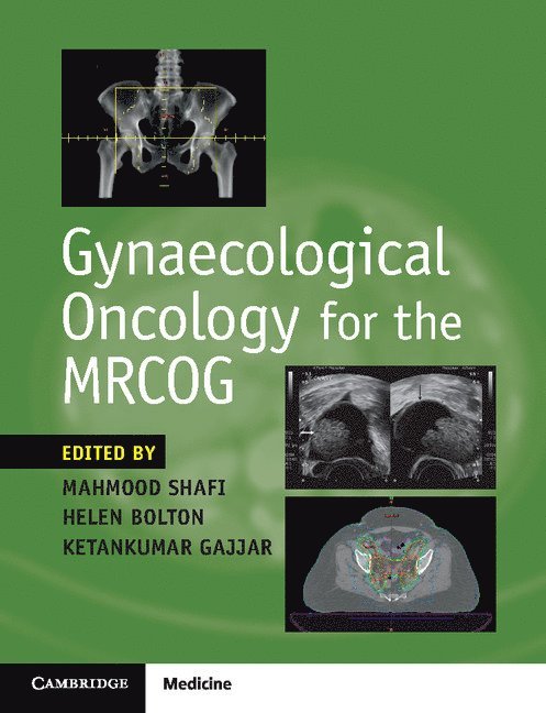 Gynaecological Oncology for the MRCOG 1