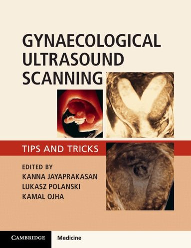 Kanna Jayaprakasan, Lukasz Polanski, Kamal Ojha - Gynaecological Ultrasound Scanning, Häftad