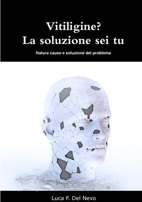 Vitiligine? La soluzione sei tu 1