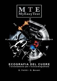 bokomslag Ecografia Del Cuore - Myeasytest