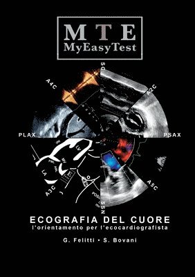 bokomslag Ecografia Del Cuore - Myeasytest