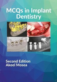 bokomslag MCQS in Implant Dentistry