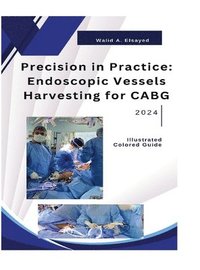 bokomslag Precision in Practice: Endoscopic Vessel Harvesting for CABG