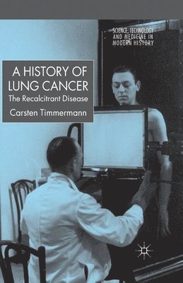 A History of Lung Cancer 1