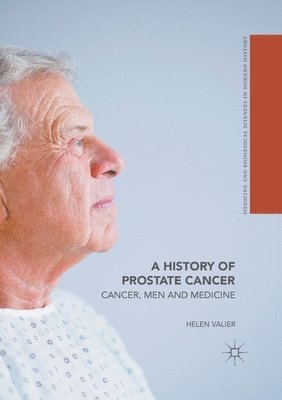 bokomslag A History of Prostate Cancer