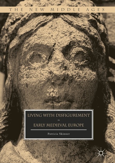 Patricia Skinner - Living with Disfigurement in Early Medieval Europe, Inbunden