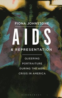 AIDS and Representation 1