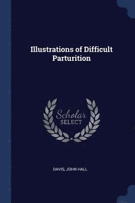 Illustrations of Difficult Parturition 1