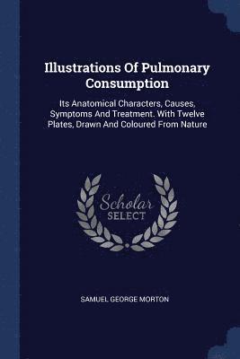 bokomslag Illustrations Of Pulmonary Consumption