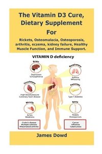 bokomslag The Vitamin D3 Cure, Dietary supplement for Rickets, Osteomalacia, Osteoporosis, arthritis, eczema, kidney failure, Healthy Muscle Function, and Immune Support.