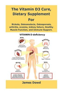 Vitamin D3 Cure, Dietary supplement for Rickets, Osteomalacia, Osteoporosis, arthritis, eczema, kidney failure, Healthy Muscle Function, and Immune Support.