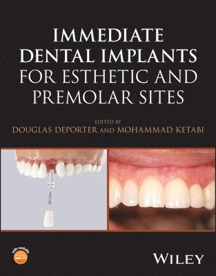 bokomslag Immediate Dental Implants for Esthetic and Premolar Sites