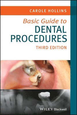 bokomslag Basic Guide to Dental Procedures