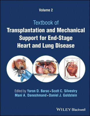 bokomslag Transplantation and Mechanical Support for End-Stage Heart and Lung Disease, Volume 2