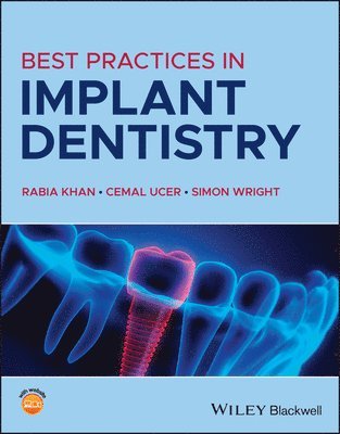 bokomslag Best Practices in Implant Dentistry
