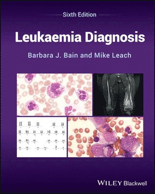 Barbara J. Bain, Mike Leach - Leukaemia Diagnosis, Inbunden