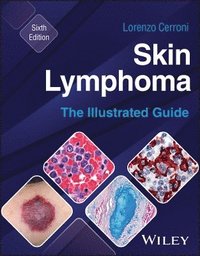 bokomslag Skin Lymphoma