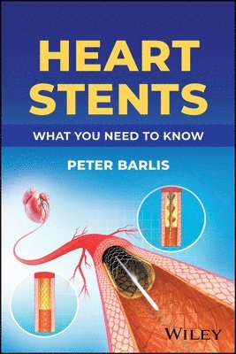 Peter Barlis, Australia) Barlis, Peter (University of Melbourne - Heart Stents, Häftad