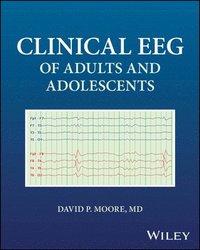 bokomslag Clinical EEG of Adults and Adolescents