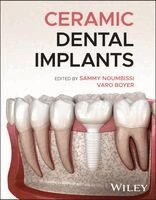 Sammy Noumbissi, Varo Boyer - Ceramic Dental Implants, Inbunden