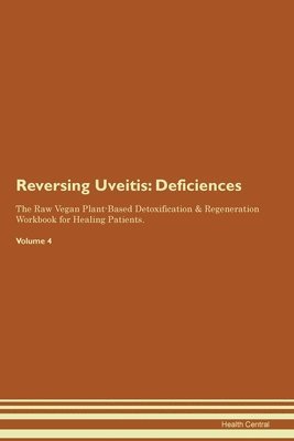 bokomslag Reversing Uveitis