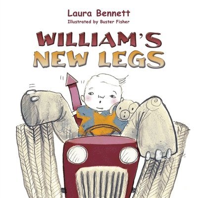 William's New Legs 1