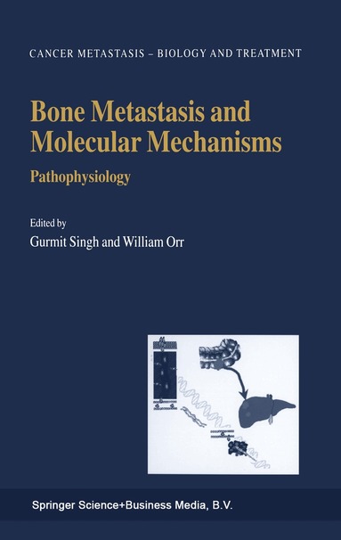 Gurmit Singh, William Orr - Bone Metastasis and Molecular Mechanisms, Inbunden