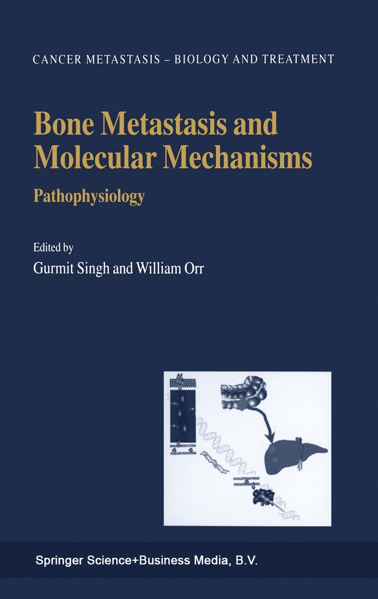 Bone Metastasis and Molecular Mechanisms 1