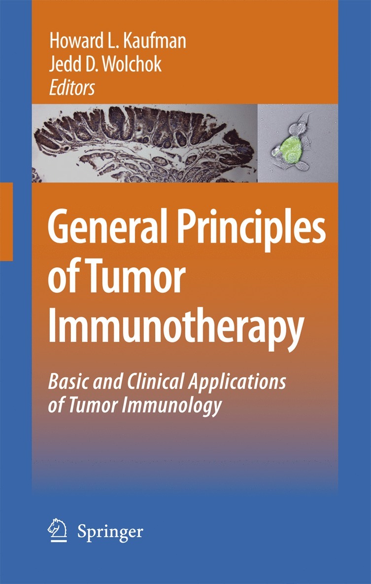 General Principles of Tumor Immunotherapy
