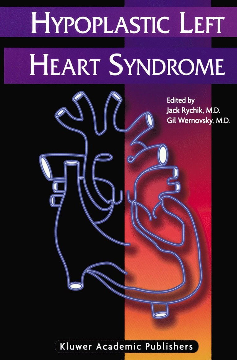 Hypoplastic Left Heart Syndrome