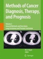Methods of Cancer Diagnosis, Therapy and Prognosis 1