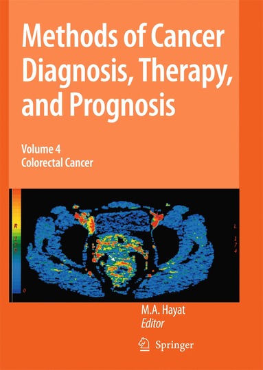 bokomslag Methods of Cancer Diagnosis, Therapy and Prognosis