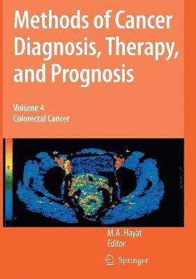 Methods of Cancer Diagnosis, Therapy and Prognosis 1