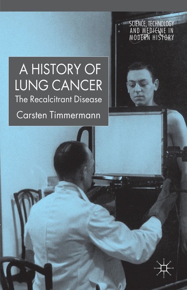 C. Timmermann - History of Lung Cancer, Inbunden