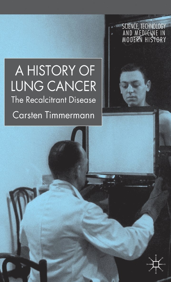 A History of Lung Cancer 1