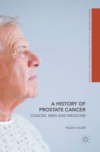 bokomslag A History of Prostate Cancer