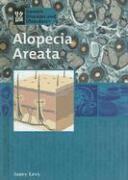 Janey Levy - Alopecia Areata, Inbunden