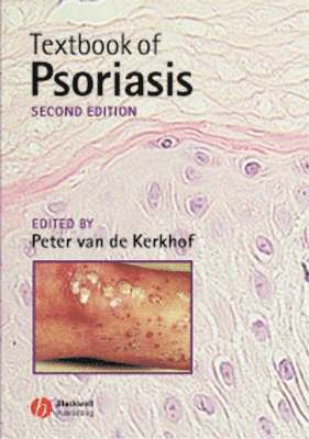 bokomslag Textbook of Psoriasis
