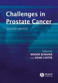 bokomslag Challenges in Prostate Cancer